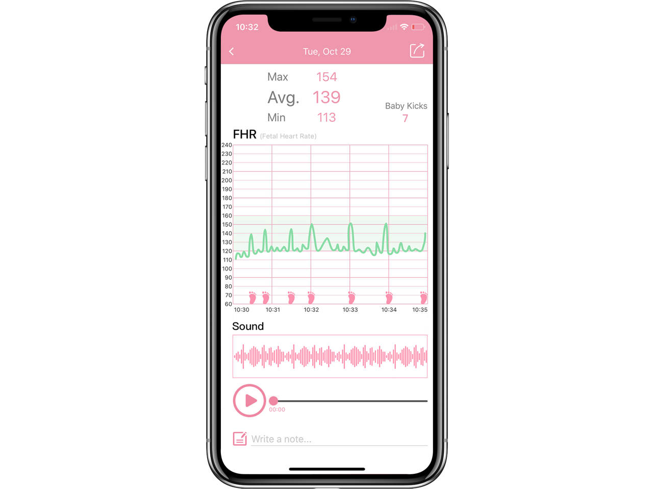fetal heart rate apple watch
