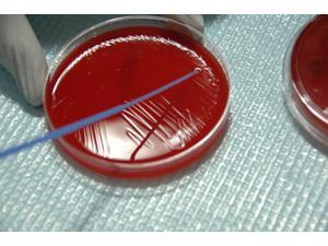 Staphylococcus Bacteria from human skin grown on agar Poster Print by National Institutes of HealthStocktrek Images (17 x 11) Staphylococcus Bacteria from human skin grown on agar Poster Print by National Institutes of HealthStocktrek Images (17 x 11)