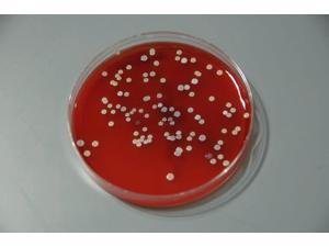 Bacteria from human skin grown on agar in the laboratory Poster Print by National Institutes of HealthStocktrek Images (17 x 11) Bacteria from human skin grown on agar in the laboratory Poster Print by National Institutes of HealthStocktrek Images (17 x 11)