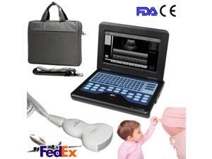 New Portable Laptop Machine Digital Ultrasound Scanner with 3.5MHZ Convex probe,CE&FDA CONTEC CMS600P2 Diagnostic system New Portable Laptop Machine Digital Ultrasound Scanner with 3.5MHZ Convex probe,CE&FDA CONTEC CMS600P2 Diagnostic system