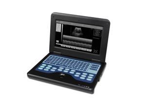 CMS600P2 portable full Digital laptop ultrasound scanner machine B-ultrasound system 10.1"LCD display with 3.5mhz convex probe