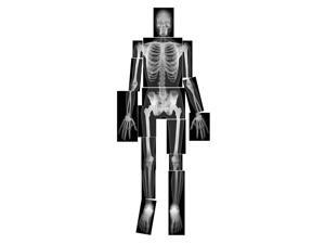 Roylco True To Life Human X-Rays Life Size 18pcs TLT R5911