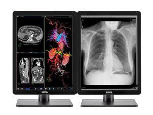 Pair (x2) Barco Nio MDNC-3421 3MP 21'' Color LED General Radiology PACS Display (K9300340A) Pair (x2) Barco Nio MDNC-3421 3MP 21'' Color LED General Radiology PACS Display (K9300340A)