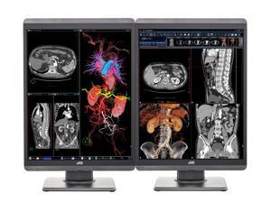 Pair (x2) JVC CL-S200 2MP 21" Color LED PACS Display Monitor (CL-S200) Pair (x2) JVC CL-S200 2MP 21" Color LED PACS Display Monitor (CL-S200)