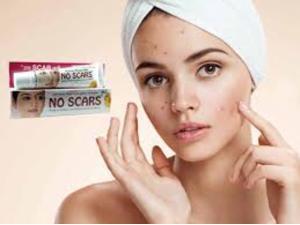 NO SCARS Cream, Helps To Reduce & Remove Scars & Marks, Hyperpigmentation, Post Pimple Scars, Dark Circles Under the Eyes 20gm