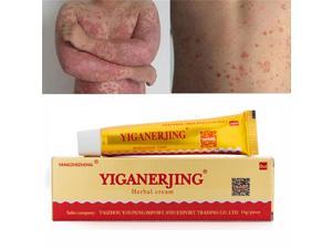 YIGANERJING Skin Psoriasis Cream Dermatitis Eczematoid Eczema Ointment
