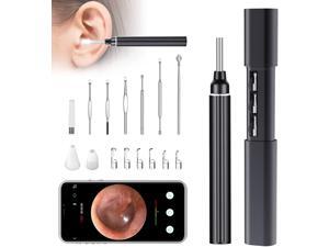 VITCOCO Ear Wax Removal, 1920P HD Wireless Otoscope Earwax Removal Tool, WiFi Ear Endoscope with LED Lights, 3mm Mini Visual Ear Inspection Camera Silicone Ear Pick Cleaning Kit for Adults Kids Pets VITCOCO Ear Wax Removal, 1920P HD Wireless Otoscope Earwax Removal Tool, WiFi Ear Endoscope with LED Lights, 3mm Mini Visual Ear Inspection Camera Silicone Ear Pick Cleaning Kit for Adults Kids Pets