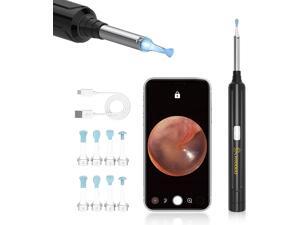 VITCOCO Ear Wax Removal, Ear Cleaner with Camera, 1296P FHD Wireless Earwax Removal Kit, Ear Wax Camera with 6 LED Lights, Waterproof Ear Wax Remover Tool for iPhone, iPad & Android Smart Phones VITCOCO Ear Wax Removal, Ear Cleaner with Camera, 1296P FHD Wireless Earwax Removal Kit, Ear Wax Camera with 6 LED Lights, Waterproof Ear Wax Remover Tool for iPhone, iPad & Android Smart Phones