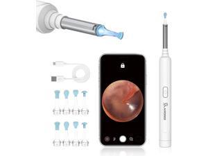 VITCOCO Ear Wax Cleaner, 1296P FHD Otoscope Ear Cleaning Kit, Ear Cleaner Earwax Removal Camera with Lights, Ear Wax Removal Tool, Earwax Removal Kit for iPhone, iPad & Android Smart Phones