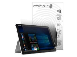 Celicious Privacy Lite (Portrait) ASUS Transformer Pro T304UA Matte Anti-Spy Screen Protector Celicious Privacy Lite (Portrait) ASUS Transformer Pro T304UA Matte Anti-Spy Screen Protector