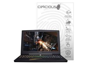 Celicious Impact Aorus X5 v8 Anti-Shock Screen Protector Celicious Impact Aorus X5 v8 Anti-Shock Screen Protector