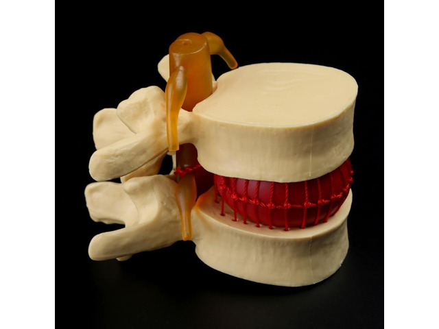 Human anatomy skeleton Spine Lumbar Disc Herniation Teaching Model brain skull traumatic pistol school supplies medical instrume