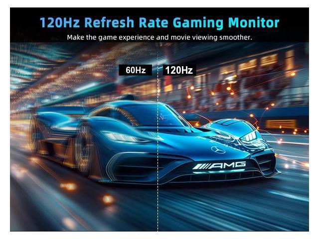 UPERFECT 18.5' 1080P Portable Monitor 120Hz Portable Gaming Monitor Switch Display w/VESA and Smart Cover For Xbox One