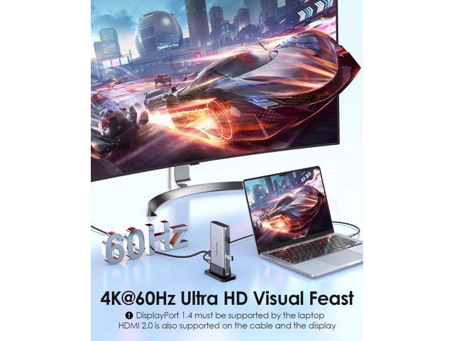 LENTION USB C Docking with 4K@60Hz HDMI, USB 3.0/2.0, Gigabit Ethernet, 100W PD, Aux Adapter for 2023-2016 MacBook Pro/Mac Air/Surface/Steam Deck,...