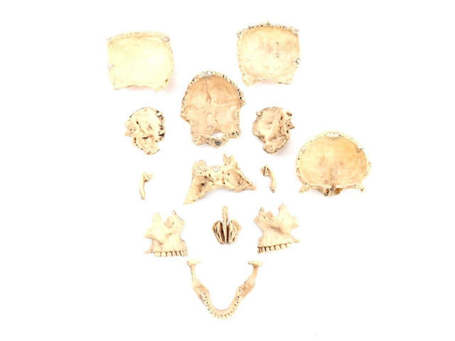 1:2 Human Skull Model Teaching Study