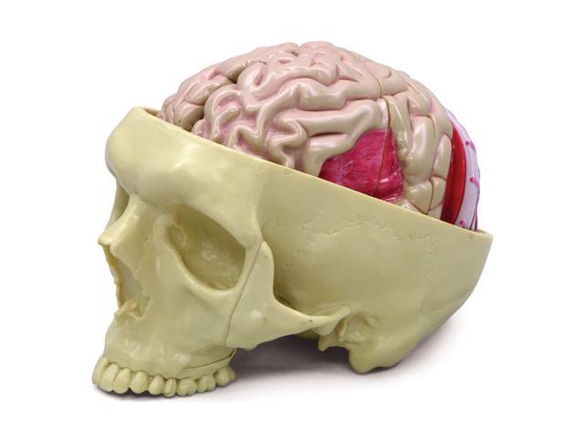 Brain Model Inside Partial Skull Afflicted by Pathologies Human Body and Anatomy Replica for Physiology Education, Anatomical Model for Doctor's.