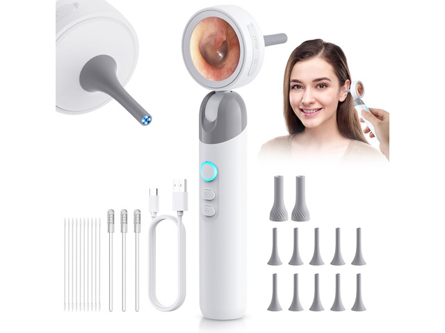 Digital Otoscope Ear Camera for Family, 1.38-Inch Screen, No App Needed Ear Scope with 4 LED Lights, 3X Magnification, Photo/Video, Telemedicine...