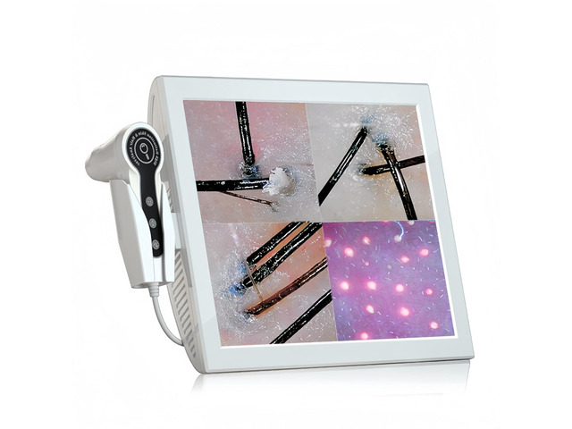 Professional 15-Inch Scalp Camera for Beauty Salons High-Resolution Hair and Scalp Analysis Device with Image Storage, Easy Assembly, Durable...