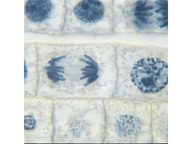 Fish and Onion Mitosis Microscope Slide and Study Guide Set