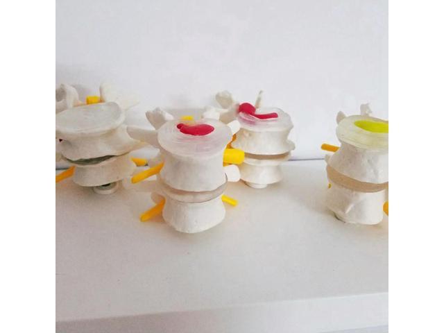1 Pcs Human Shoulder Joint Model,Accurate Shoulder Skeleton & 1 Pcs Human Anatomy Skeleton Spine 4-Stages Supplies