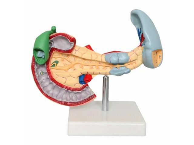 Duodenum And Spleen Pathology Model Pathological Pancreas And Spleen Model Anatomy Pathological Learning