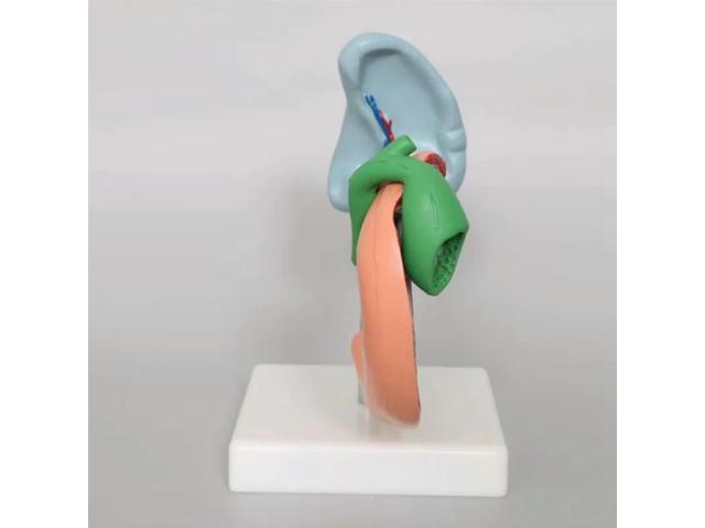 Duodenum And Spleen Pathology Model Pathological Pancreas And Spleen Model Anatomy Pathological Learning