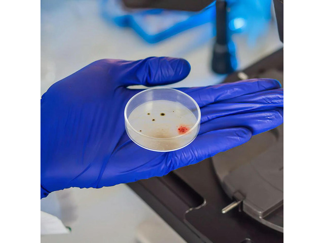 10Pcs 60Mm Flat Surface Glass Petri Dishes with Vented Lids Even Cell Growth Reusable Plates for Tissue Culture