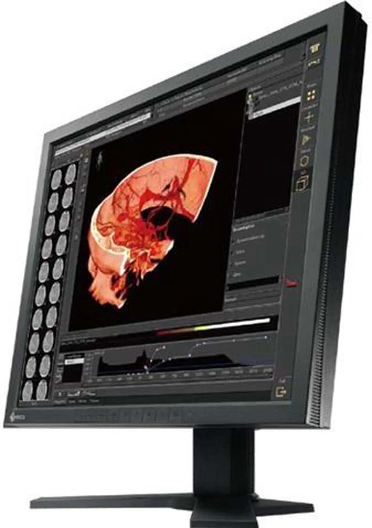 Main image of Eizo RadiForce RS110 19' LCD Monitor - 25 ms