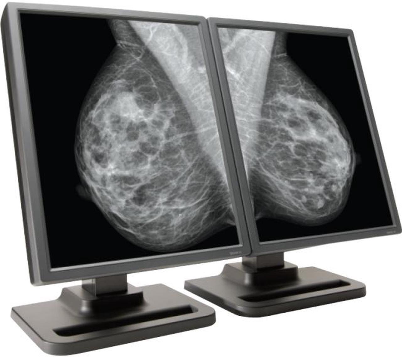 Main image of NDS Surgical Imaging Dome E5 21.3" LCD Monitor - 50 ms