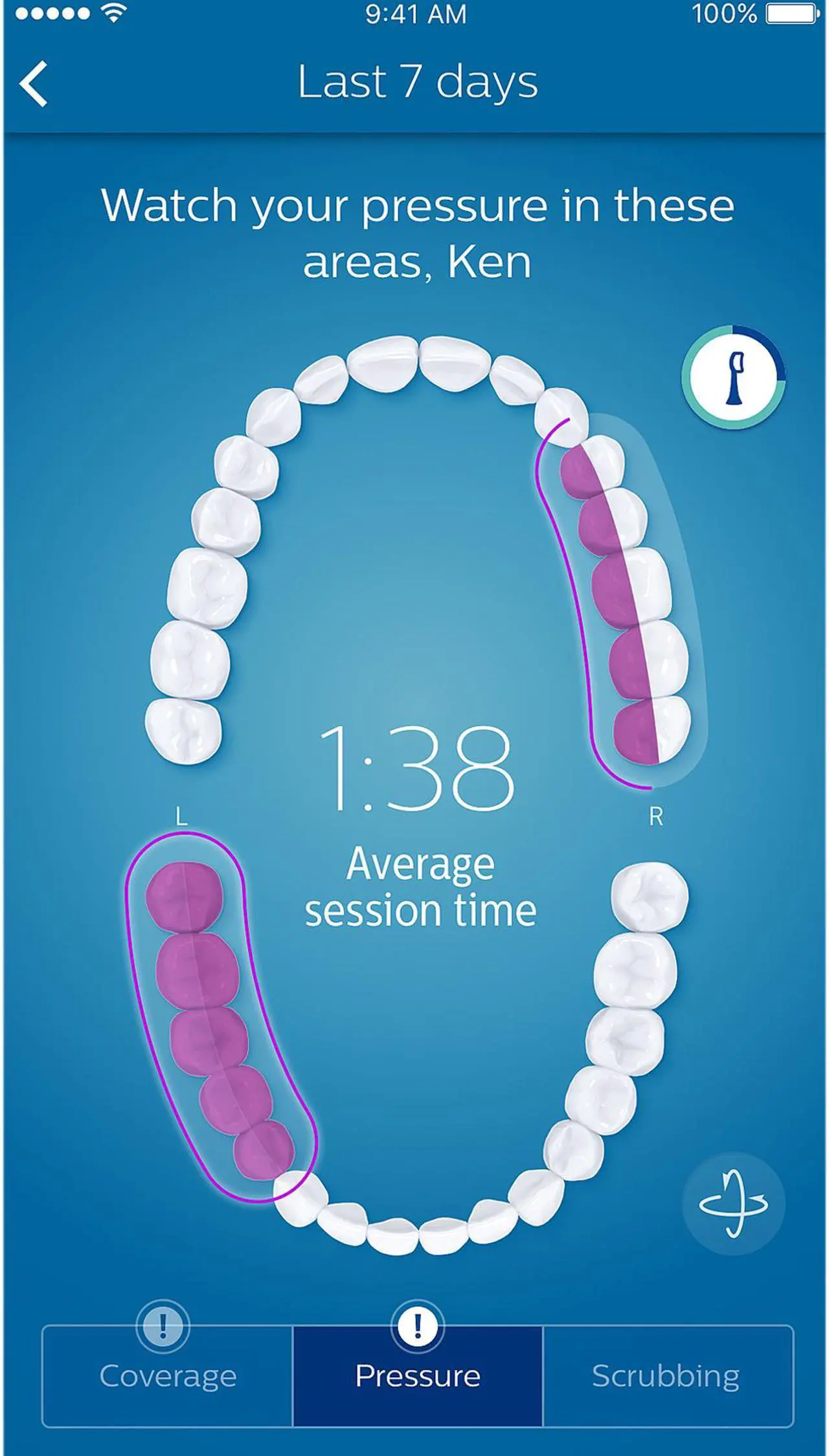 Alt view image 11 of 13 - Philips Sonicare DiamondClean Smart 9300 Rechargeable Electric Power Toothbrush, Pink (HX9903/21)