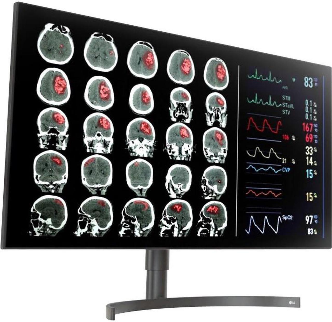 Alt view image 6 of 14 - LG 32HL512D-B 31.5" 3840x2160 4K LCD IPS 5ms HDMI DisplayPort Monitor