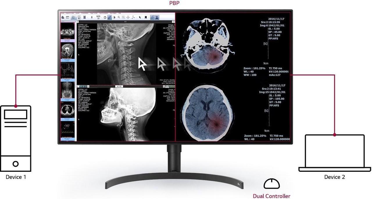Alt view image 7 of 14 - LG 32HL512D-B 31.5" 3840x2160 4K LCD IPS 5ms HDMI DisplayPort Monitor