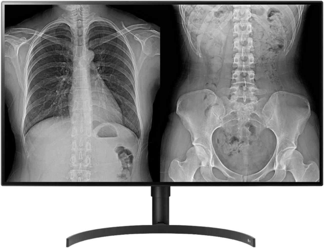 Alt view image 13 of 14 - LG 32HL512D-B 31.5" 3840x2160 4K LCD IPS 5ms HDMI DisplayPort Monitor
