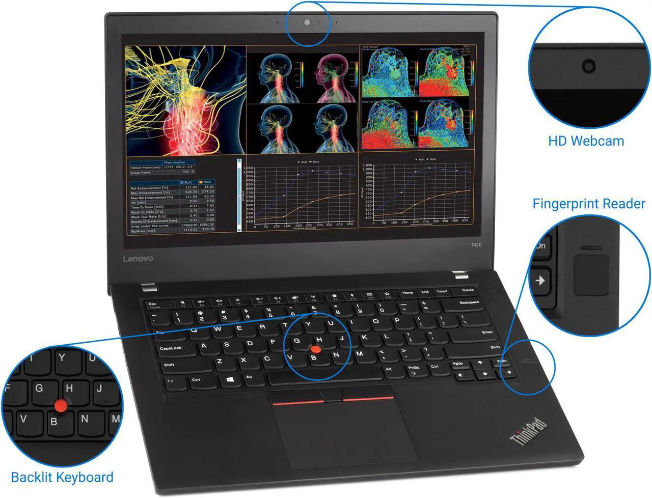 Alt view image 6 of 7 - Lenovo ThinkPad T470 Notebook, 14" HD Display, Intel Core i5-6300U Upto 3, 8GB RAM, 128GB NVMe SSD, HDMI, Thunderbolt, Card Reader, Wi-Fi, Bluetooth, Windows 10 Pro