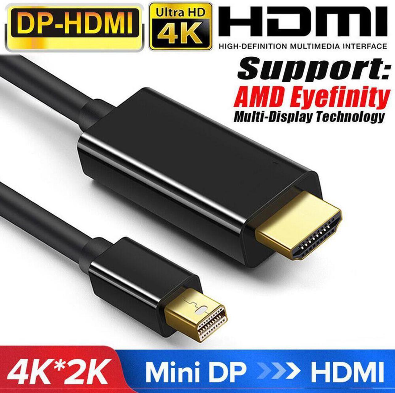 Mini DisplayPort to HDMI Cable, Benfei Mini DP to HDMI 6 Feet Cable (Thunderbolt Compatible) with MacBook Air/Pro, Surface Pro/Dock, Monitor, Projector - Black