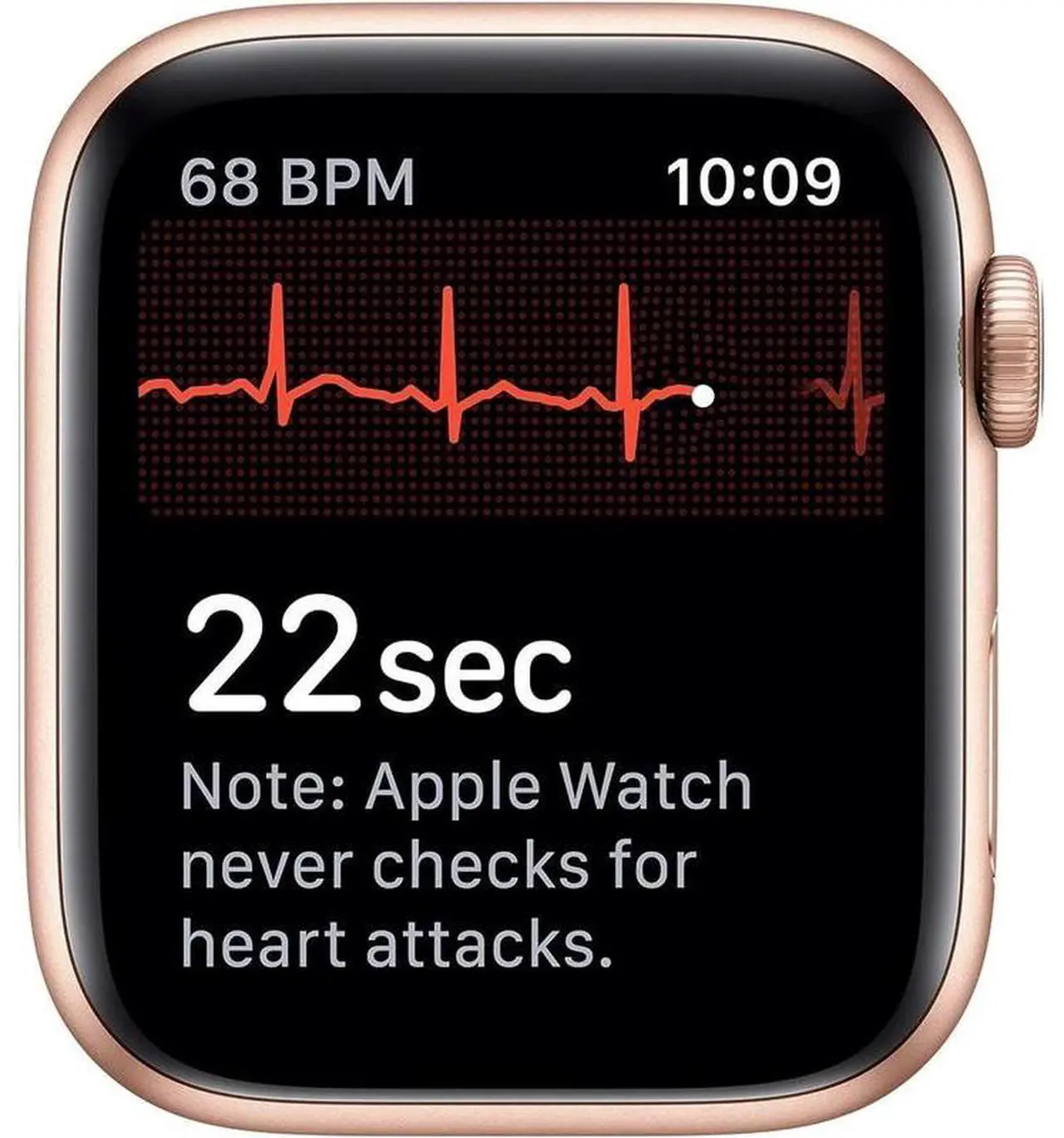 Alt view image 5 of 5 - Apple Apple Watch Series 4 40 mm Fully Unlocked - Gold GPS + Cellular (Grade A)