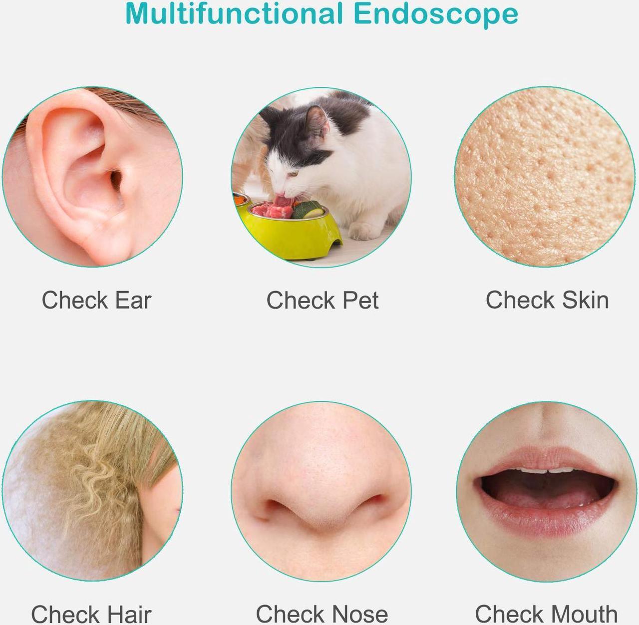 Alt view image 3 of 7 - Ear Camera,Wireless Otoscope with 1.3 MP HD Digital, WiFi Ear Scope for Ear Cleaning, Waterproof Otoscope with 6 Adjustable LED Lights for iPhone, Android and Windows