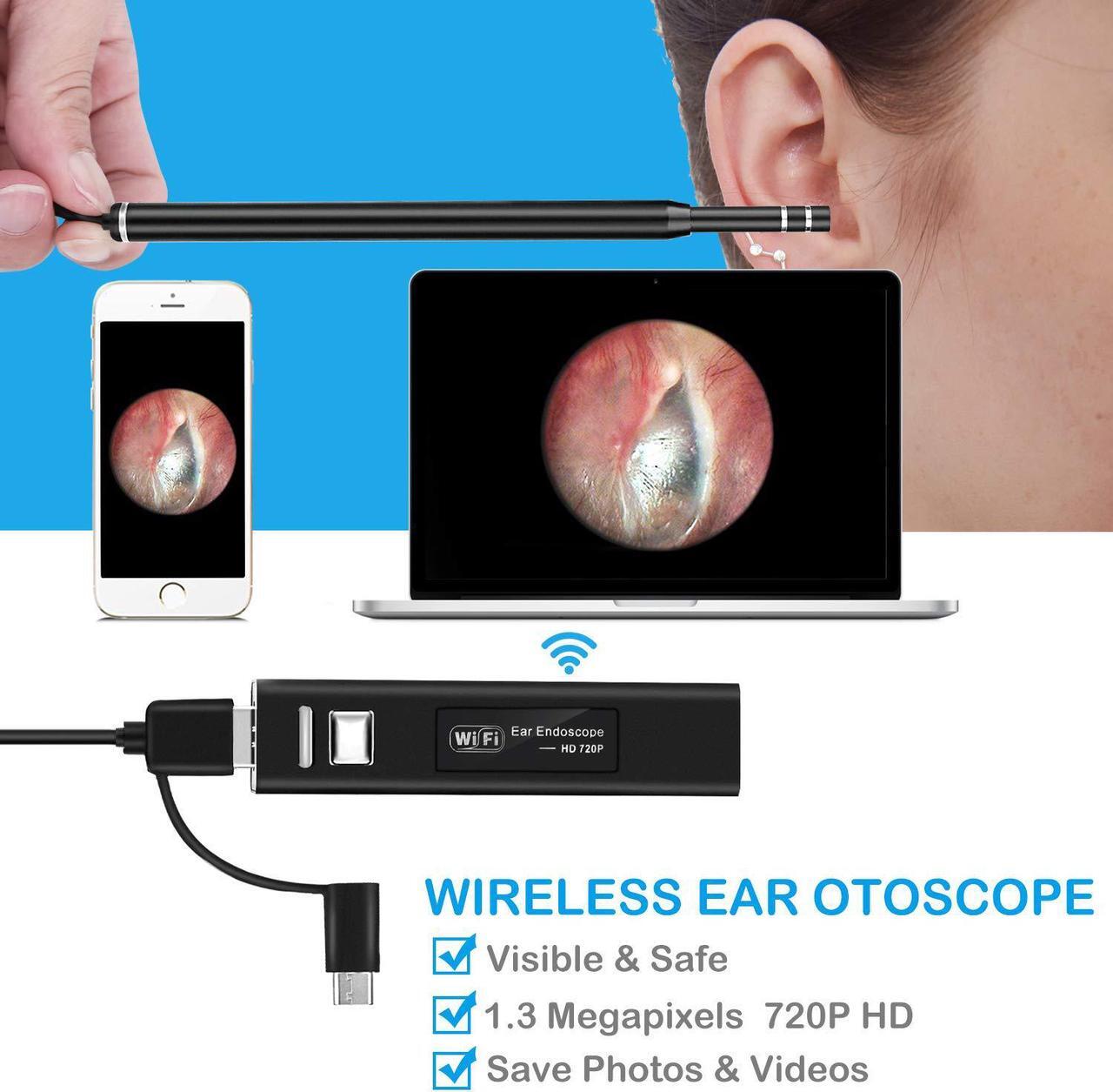 Alt view image 2 of 7 - Ear Camera,Wireless Otoscope with 1.3 MP HD Digital, WiFi Ear Scope for Ear Cleaning, Waterproof Otoscope with 6 Adjustable LED Lights for iPhone, Android and Windows