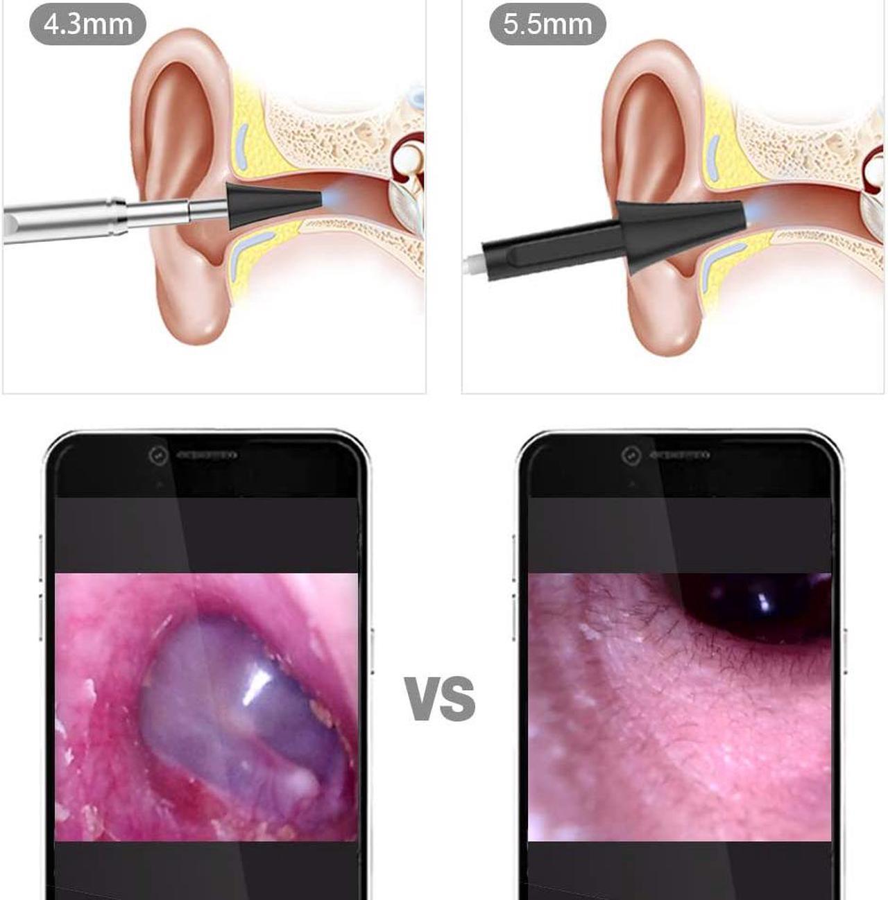 Alt view image 2 of 6 - Otoscope for iPhone, 4.3mm HD Inspection Camera, Ear Microscope, 6 Adjustable LED Lights with Ear Wax Removal Tools, Works with for iPhone, iPad & Android