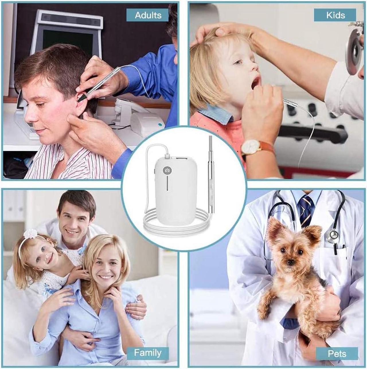 Alt view image 5 of 6 - Otoscope for iPhone, 4.3mm HD Inspection Camera, Ear Microscope, 6 Adjustable LED Lights with Ear Wax Removal Tools, Works with for iPhone, iPad & Android