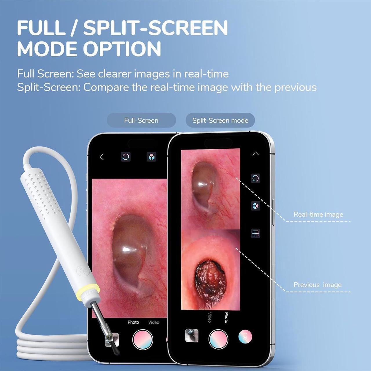 Alt view image 5 of 7 - 3.9mm Ultra-Thin Ear Camera 6 LED Lights,Digital Otoscope Ear Wax Removal Tool
