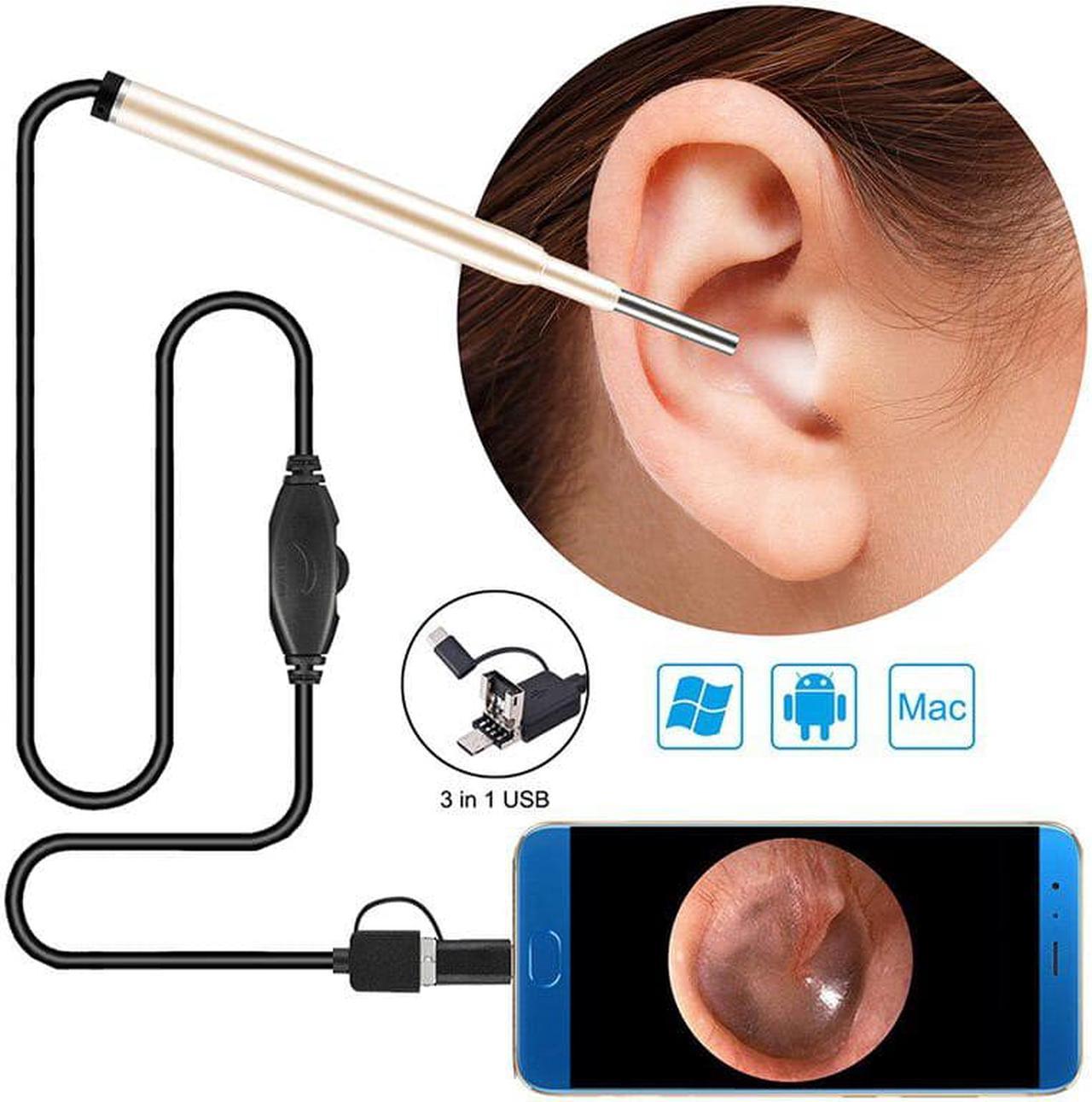 3 in 1 Ear Cleaning Endoscope 3.9MM Child Ear Otoscope Ear Scope Inspection Camera with 6 Adjustable LEDs For PC USB-C Android