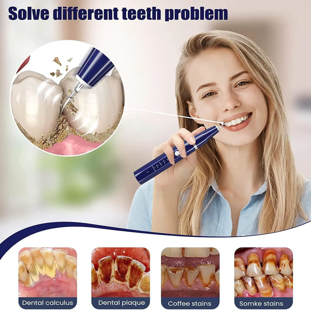 Alt view image 5 of 6 - Plaque/Tartar Remover for Teeth, Dental Calculus Remover Teeth Cleaning Kit with LED Light & 5 Adjustable Modes