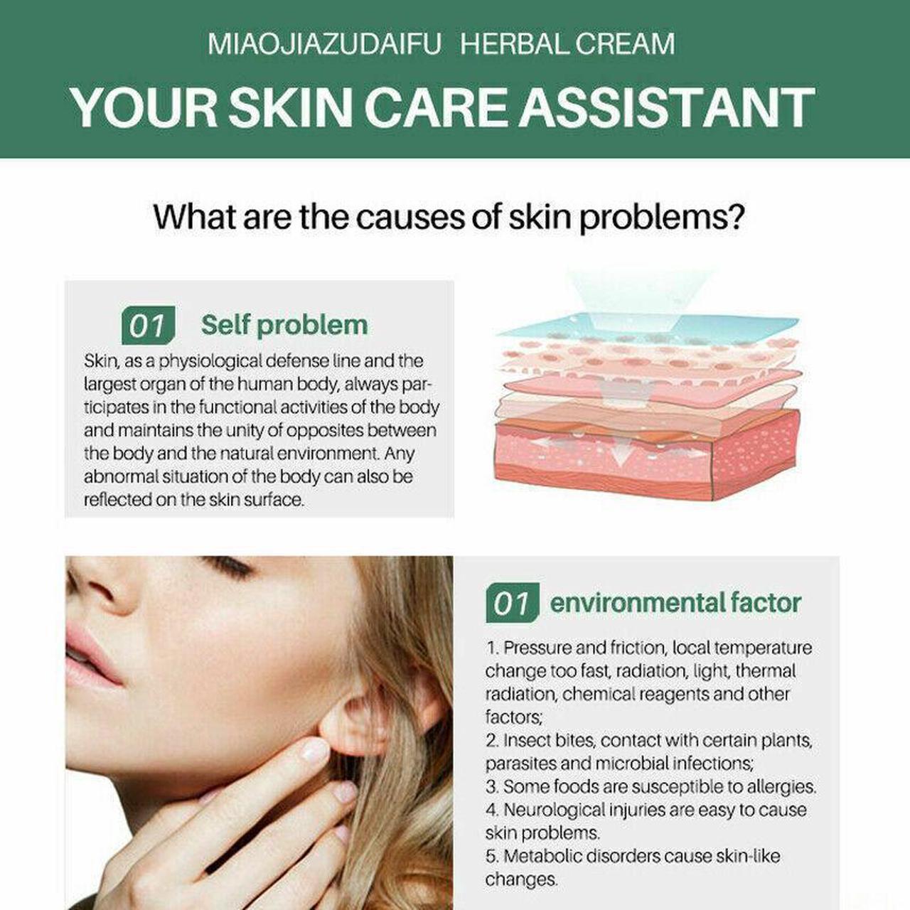 Alt view image 7 of 7 - ZUDAIFU Herbal Cream Chinese Herbal Eczema, Psoriasis Creams Dermatitis and Eczema Pruritus Psoriasis Skin Care Ointment