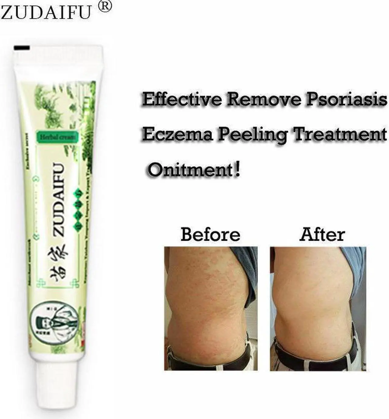 Alt view image 2 of 7 - 5 Piece ZUDAIFU Skin Psoriasis Cream Antibacterial Cream Redness Itchiness Eczema Rosacea Cutitis Chinese Herbal Cream
