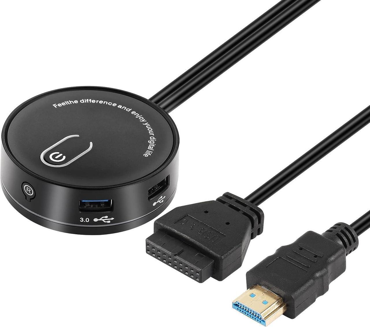 Main image of CERRXIAN Computer Case Power Supply Reset Switch Box,PC Power Button On/Off + Reset + Dual USB Ports + 3.5MM TRRS Audio + Type-C Power Interface,Desktop Computer Case Switch with Cables(USB 19pin)