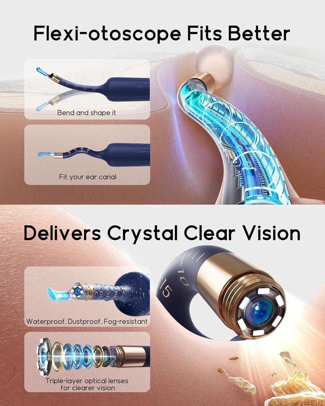 Alt view image 3 of 7 - Earsight Plus Ear Wax Removal Tool Camera, Ear Cleaner with Flexible Wireless Ear Camera Otoscope, Painless Visual Ear Pick Tweezers Wax Remover, Portable Ear Cleaning Kit for Adults/Kids, Blue