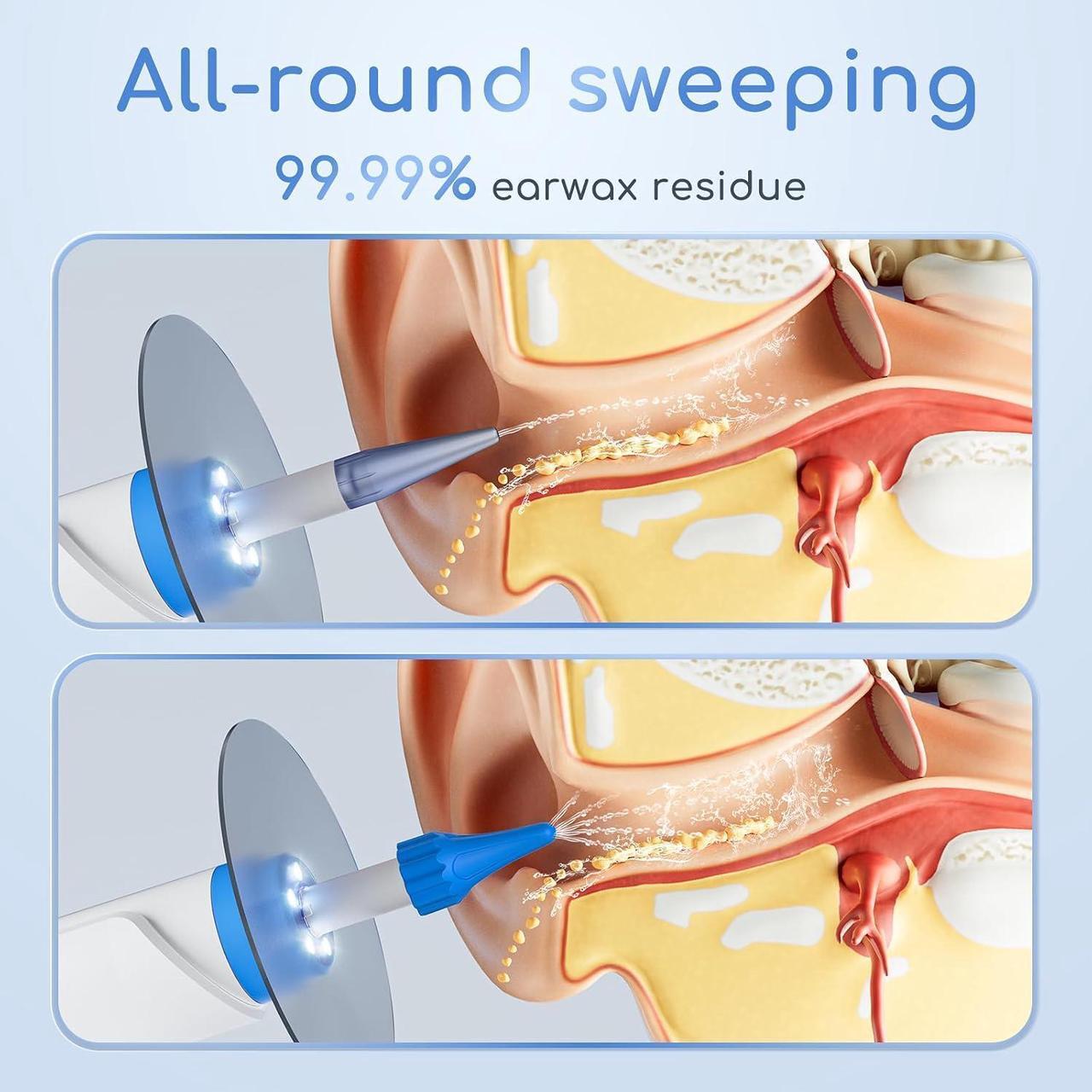 Alt view image 3 of 7 - Electric Ear Irrigation Kit with 4 Pressure Modes, Ear Cleaner with Camera, 1080P Otoscope, Ear Cleaning Tool with 7-Piece Set, Earwax Removal Kit for Daily Cleaning