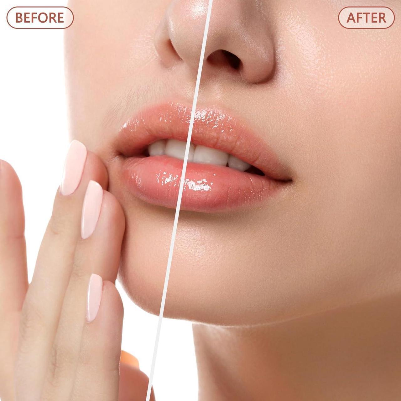 Alt view image 3 of 6 - Facial Hair Remover for Women - as Seen on TV Painless Face Shaver - Electric Hair Removal Device for Face Lips Peach Fuzz with Light (Blue)