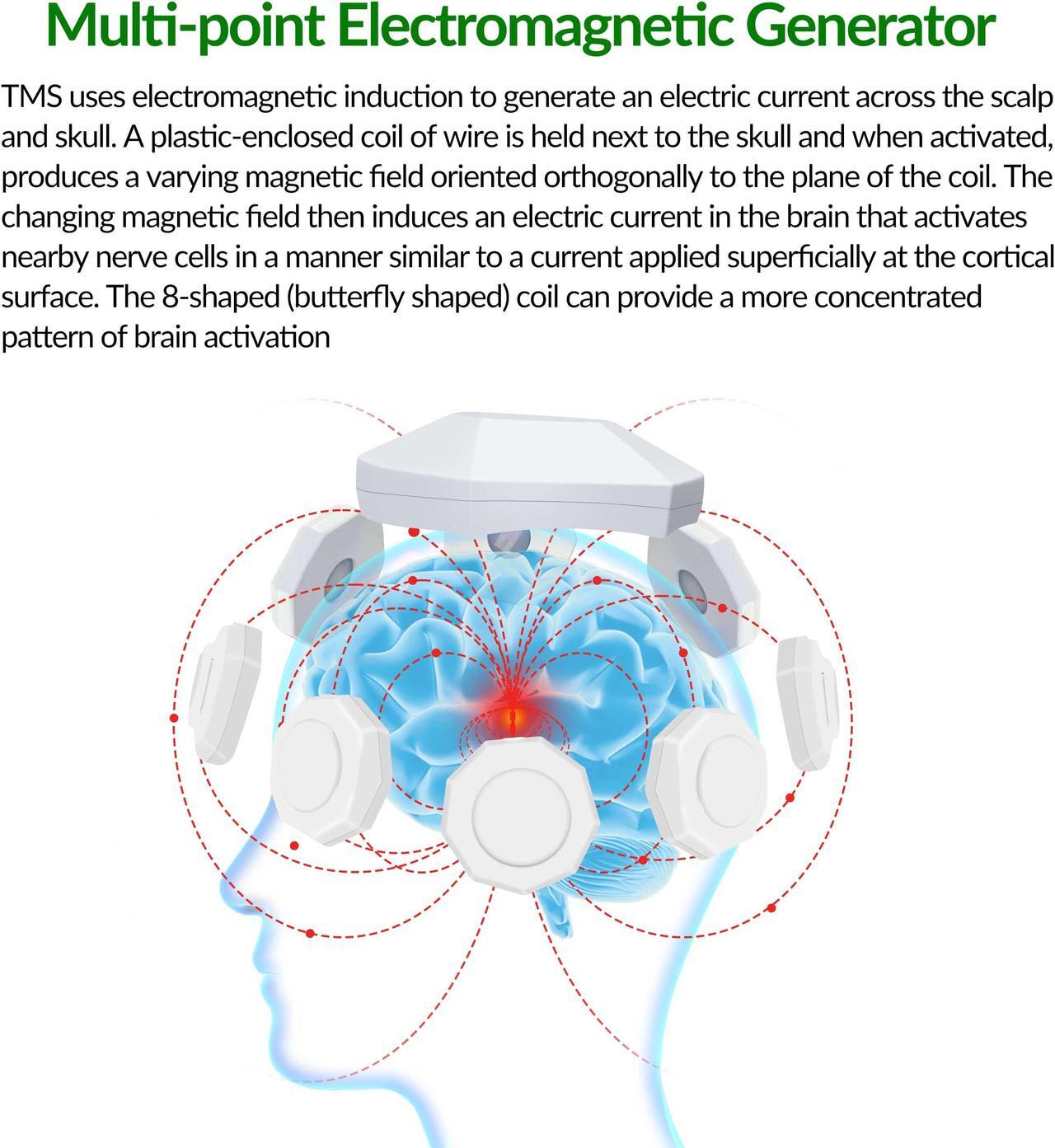 Alt view image 4 of 7 - ZJZK Tms Treatment For Depression Brain Stimulation Device For Major Depressive Disorder Mdd Neuropathic Pain Migraine